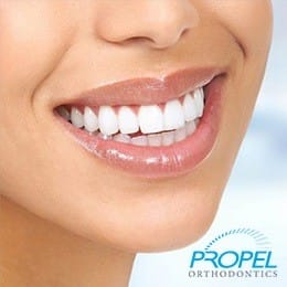 Closeup of flawlessly aligned smile