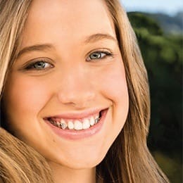 Teen girl with braces