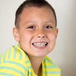 young boy with braces