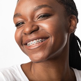 A young girl showing off her top row of metal braces