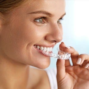 Woman placing an Invisalign tray