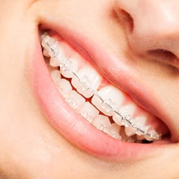 A woman with braces