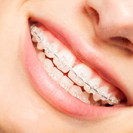 A woman with braces