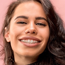 A young woman with dark, curly hair smiling with an up-close view of her clear/ceramic braces