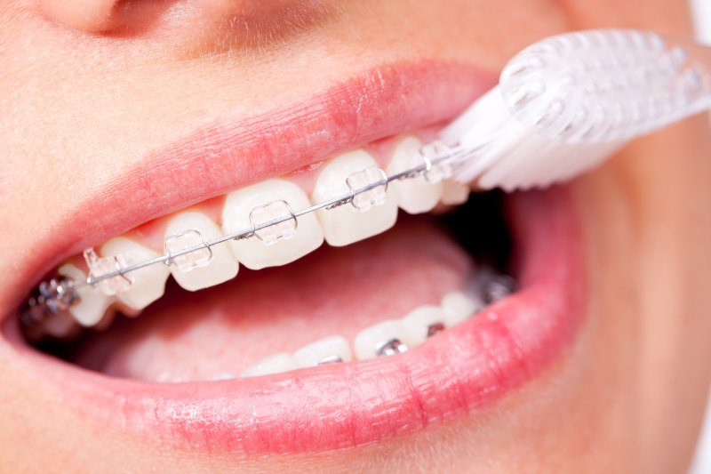 an up-close look at a person brushing their teeth and braces