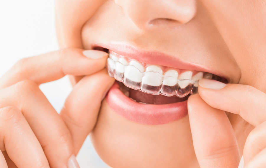 Woman putting on a clear retainer